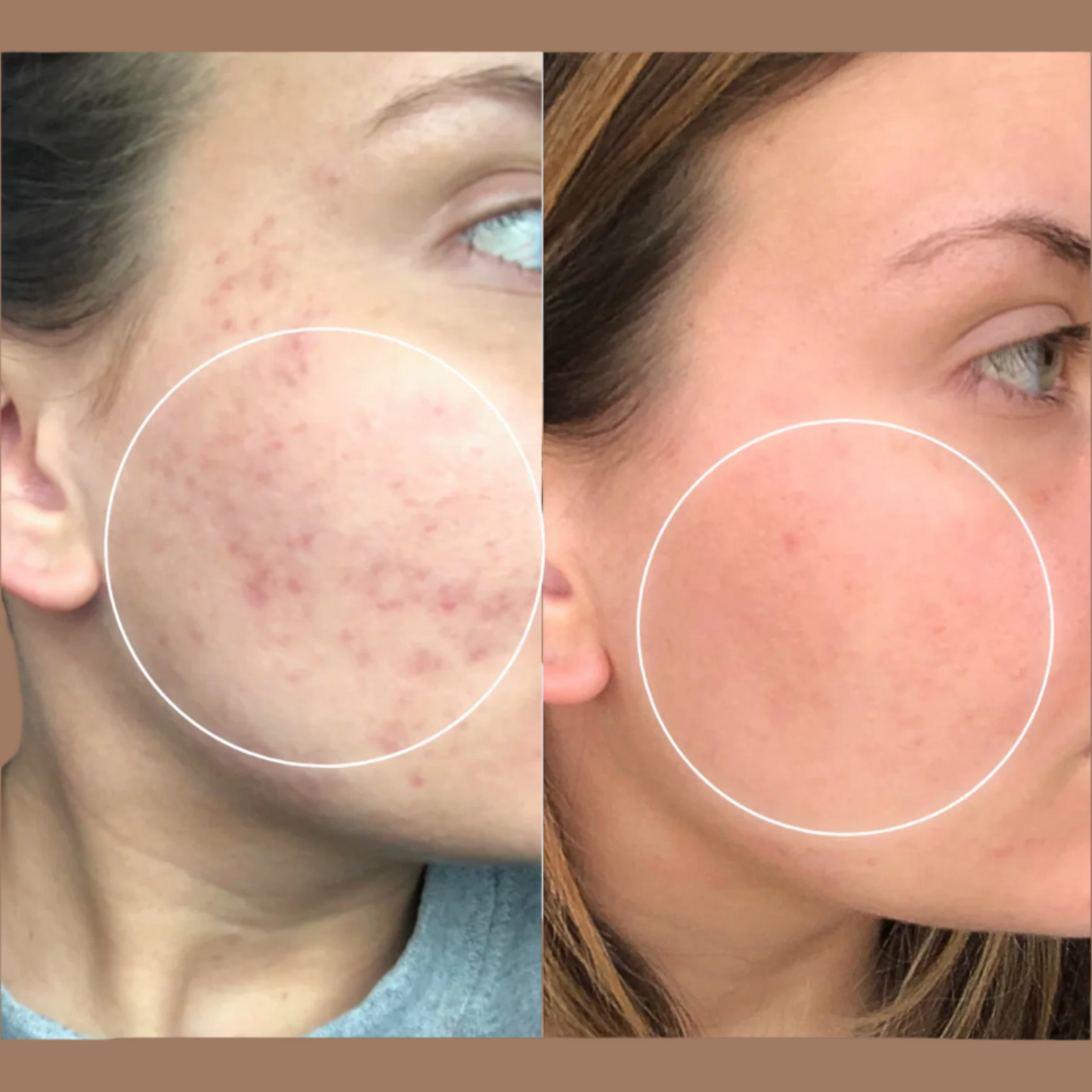 Skin Rescue Wand