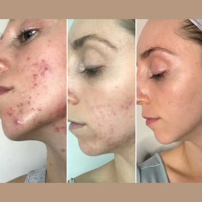 Skin Rescue Wand